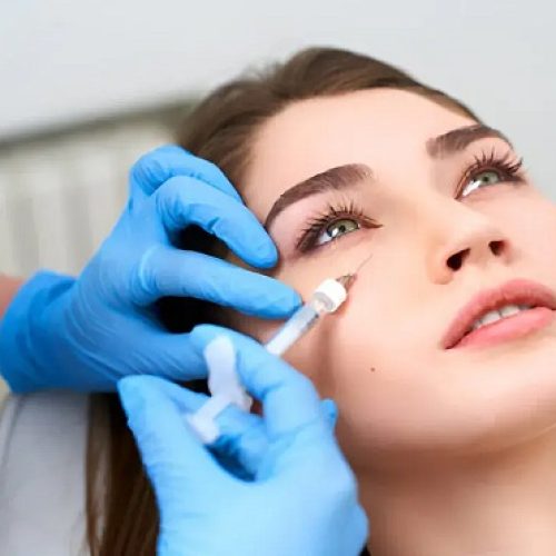 تزریق-فیلر-زیر-چشم